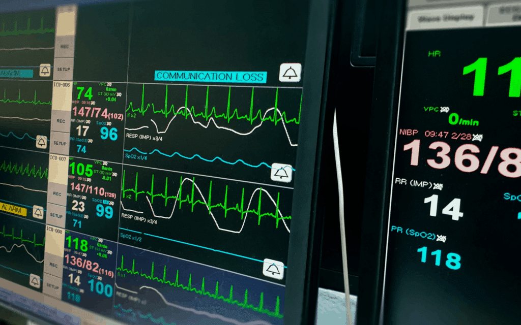 How to Manage Atrial Fibrillation with Rapid Ventricular Response: Tips for Nurses