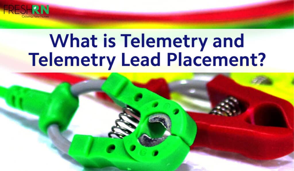 What is Telemetry and Telemetry Lead Placement?