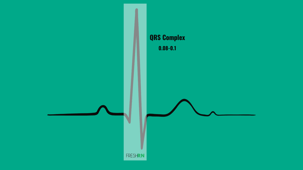 5-Lead ECG Interpretation for Nurses 4 QRS complex illustration showing where to measure from for a 5 lead ECG interpretation
