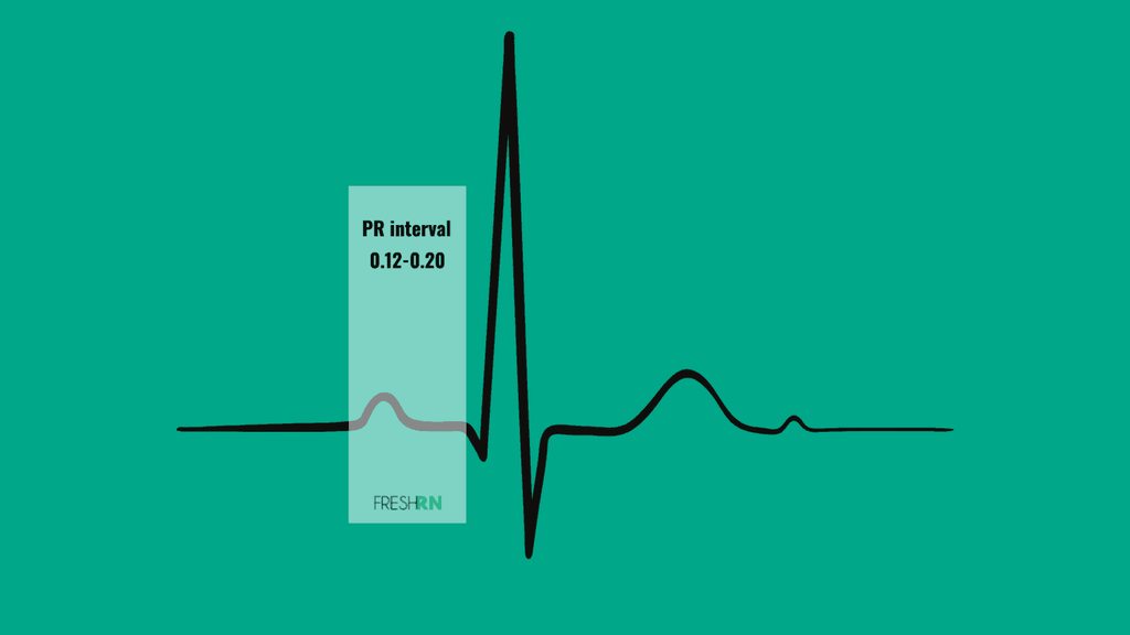 5-Lead ECG Interpretation for Nurses 3 QRS complex showing the PR interval and measurement for 5 lead ecg interpretation
