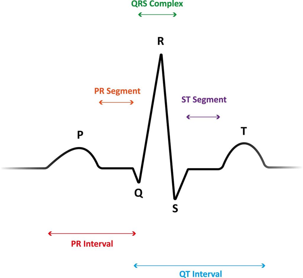 5-Lead ECG Interpretation for Nurses 2 diagram of a QRS waveform complex to aid 5 lead ECG interpretation