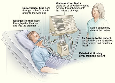 ventilator illustration with ICU nurse and patient, common icu equipment